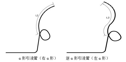 经鼻胆汁外引流管注册审查指导原则（2022年第41号）(图13)