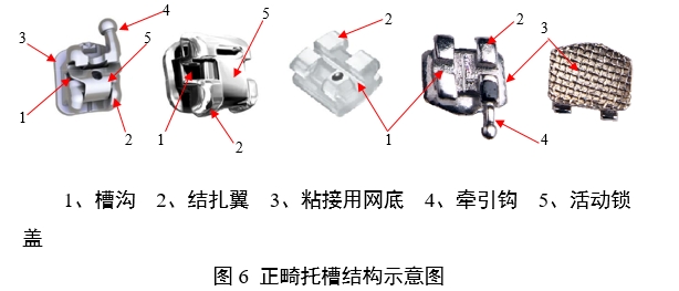 正畸托槽注册审查指导原则（2022年第41号）(图6)