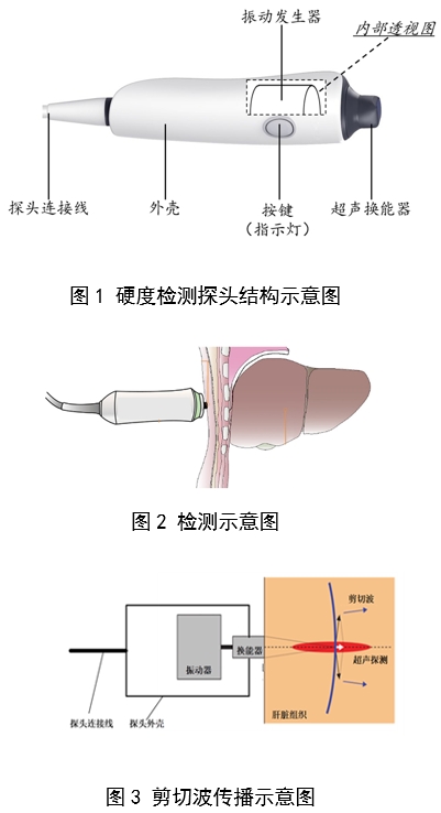 定量剪切波超声肝脏测量仪注册审查指导原则（2023年第7号）(图2)