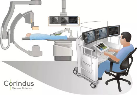 血管腔内介入手术机器人首例临床试验案例及未来发展方向(图2)