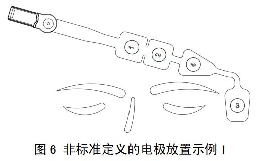 一次性使用脑电电极注册审查指导原则（2022年第35号）(图5)