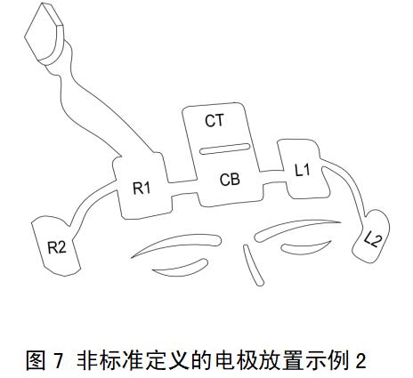 一次性使用脑电电极注册审查指导原则（2022年第35号）(图6)